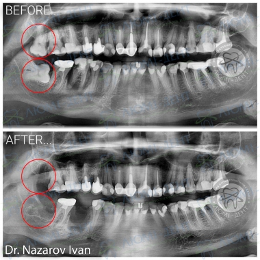 Dentistry «Lumi-Dent» in Kyiv