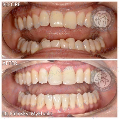 Dentistry «Lumi-Dent» in Kyiv