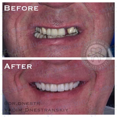 Dentistry Lumi-Dent in Kyiv