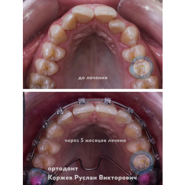 Брекеты Люми-Дент Киев Коржев Руслан Викторович