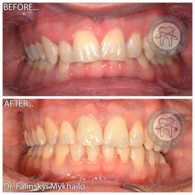 Dentistry «Lumi-Dent» in Kyiv