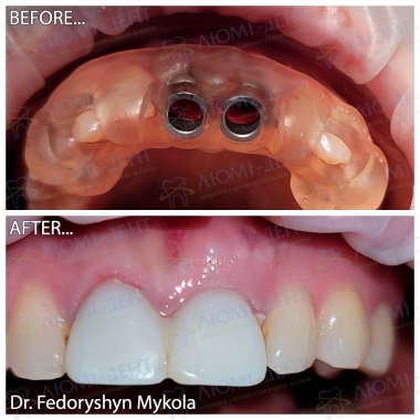 Dentistry «Lumi-Dent» in Kyiv