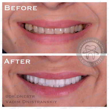 Dentistry Lumi-Dent in Kyiv