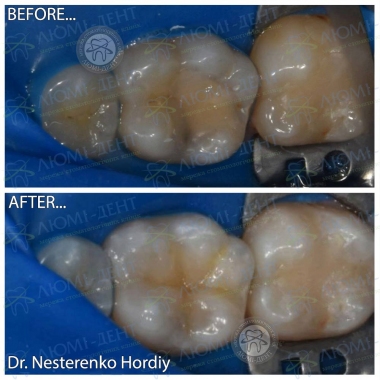 Dentistry Lumi-Dent in Kyiv