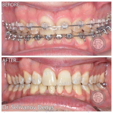 Dentistry «Lumi-Dent» in Kyiv
