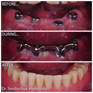 примеры работ хирург Сердийчук Климентий