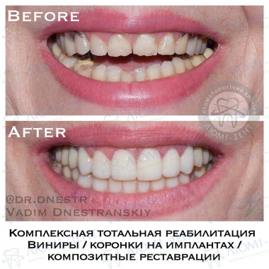 Dentistry Lumi-Dent in Kyiv