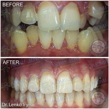 Dentistry «Lumi-Dent» in Kyiv