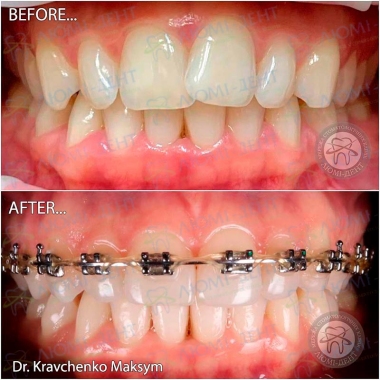 Dentistry «Lumi-Dent» in Kyiv