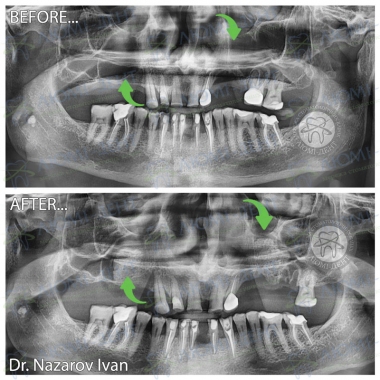 Dentistry «Lumi-Dent» in Kyiv