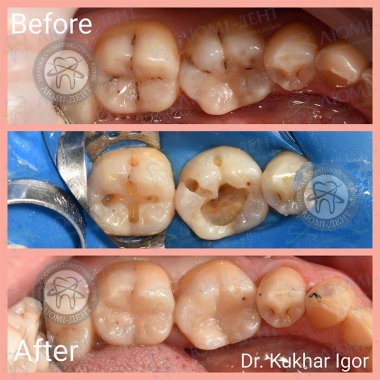 Dentistry «Lumi-Dent» in Kyiv