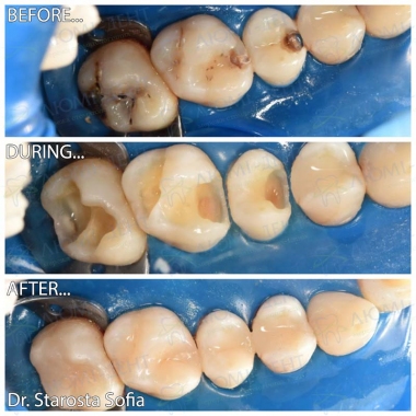 Примеры работ доктора Староста С.Б.