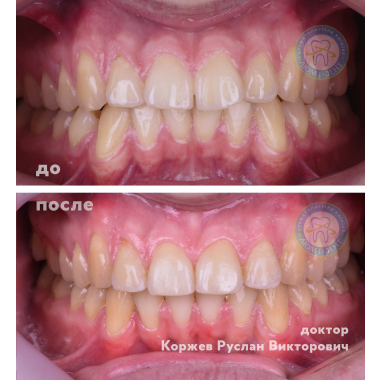 Врач стоматолог-ортодонт Люми-Дент Киев Коржев Р. В.