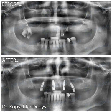 Dentistry «Lumi-Dent» in Kyiv