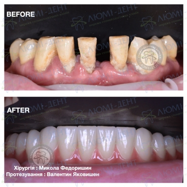 Dentistry «Lumi-Dent» in Kyiv