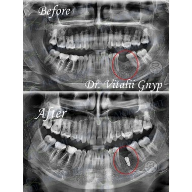 Dentistry Lumi-Dent in Kyiv