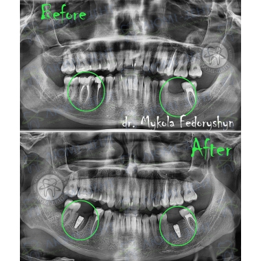 Dentistry Lumi-Dent in Kyiv