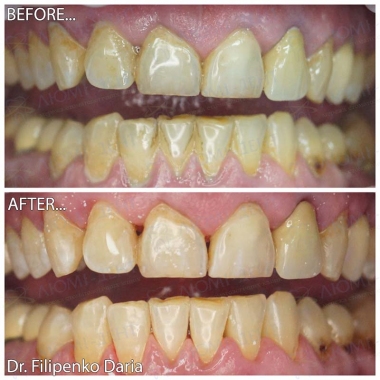 Стоматологія «Люмі-Дент» в Києві