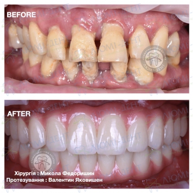 Dentistry «Lumi-Dent» in Kyiv