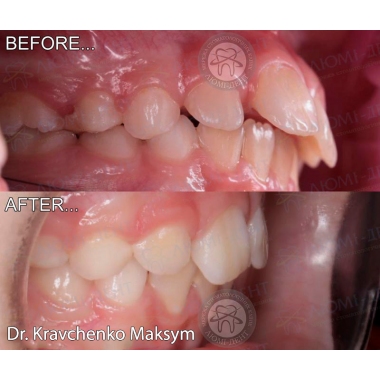 Dentistry «Lumi-Dent» in Kyiv
