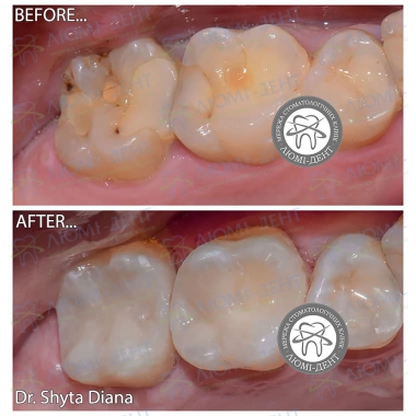 Dentistry «Lumi-Dent» in Kyiv