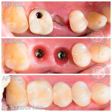 Dentistry «Lumi-Dent» in Kyiv