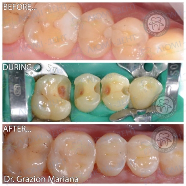 стоматолог-терапевт Гразион Марьяна