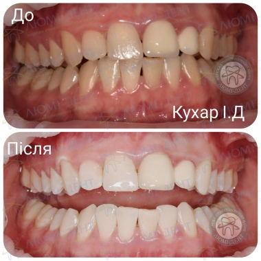 Dentistry Lumi-Dent in Kyiv