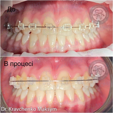 Dentistry «Lumi-Dent» in Kyiv