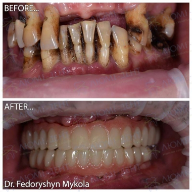 Dentistry «Lumi-Dent» in Kyiv
