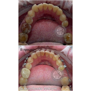 Dentistry «Lumi-Dent» in Kyiv
