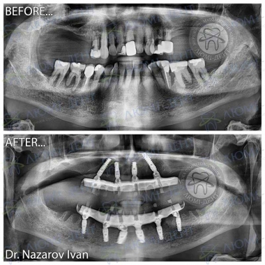 Dentistry «Lumi-Dent» in Kyiv