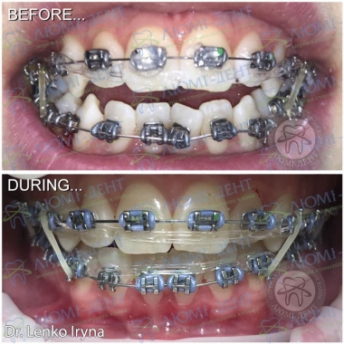 Dentistry «Lumi-Dent» in Kyiv