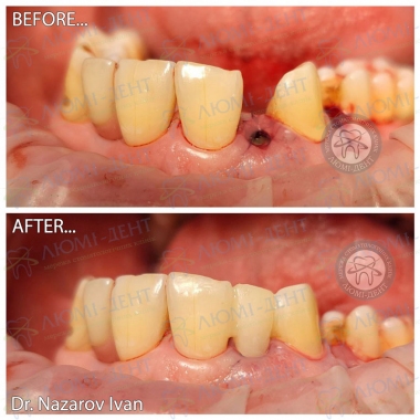 Dentistry «Lumi-Dent» in Kyiv
