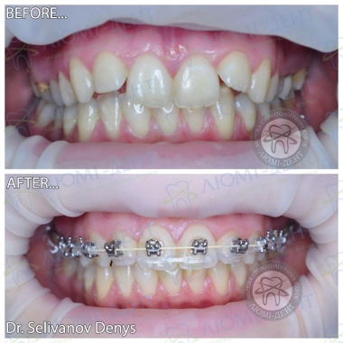 Dentistry «Lumi-Dent» in Kyiv