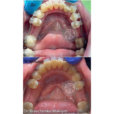 Dentistry «Lumi-Dent» in Kyiv