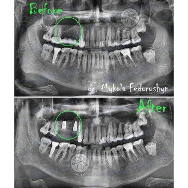 Dentistry Lumi-Dent in Kyiv