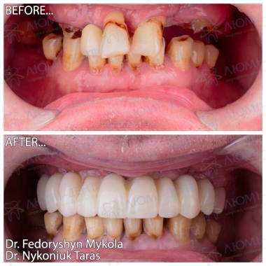 Dentistry «Lumi-Dent» in Kyiv