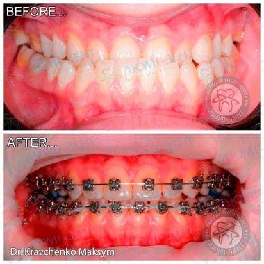 Dentistry «Lumi-Dent» in Kyiv