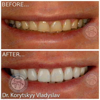 Dentistry Lumi-Dent in Kyiv