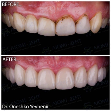 Dentistry «Lumi-Dent» in Kyiv