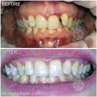 Dentistry «Lumi-Dent» in Kyiv