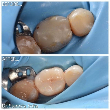 Примеры работ доктора Староста С.Б.