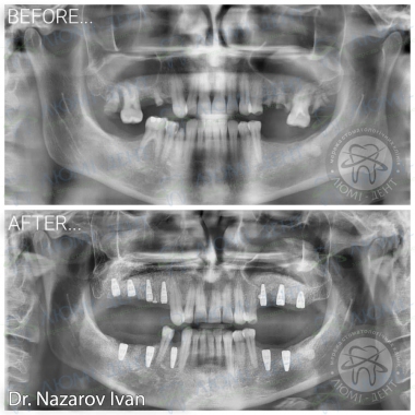 Dentistry «Lumi-Dent» in Kyiv