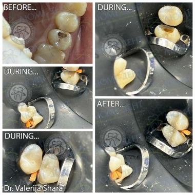 Работа врача стоматолога Шары Валерии Григорьевны