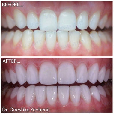 Dentistry «Lumi-Dent» in Kyiv