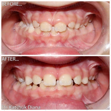 Dentistry «Lumi-Dent» in Kyiv Dentistry «Lumi-Dent» in Kyiv