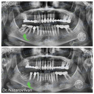 Dentistry «Lumi-Dent» in Kyiv