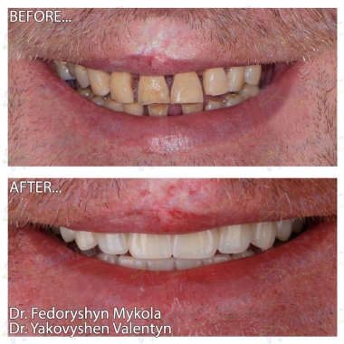 Dentistry «Lumi-Dent» in Kyiv