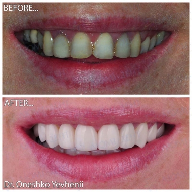 Dentistry «Lumi-Dent» in Kyiv